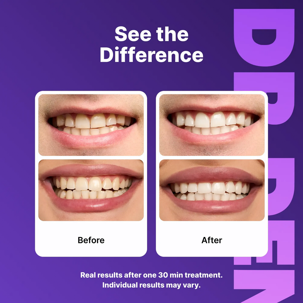 Purple Teeth Whitening Strips 7/21 Whitening Sessions Safe for Gold Does Not Cause Teeth Sensitivity Peroxide Free