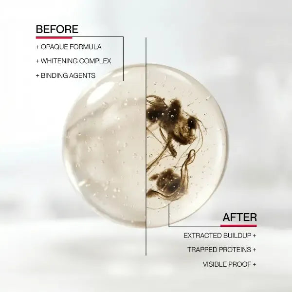 Hismile iD Stain Whitening Mouthwash for White Teeth, Freshens Breath with Essential Oils 237ml