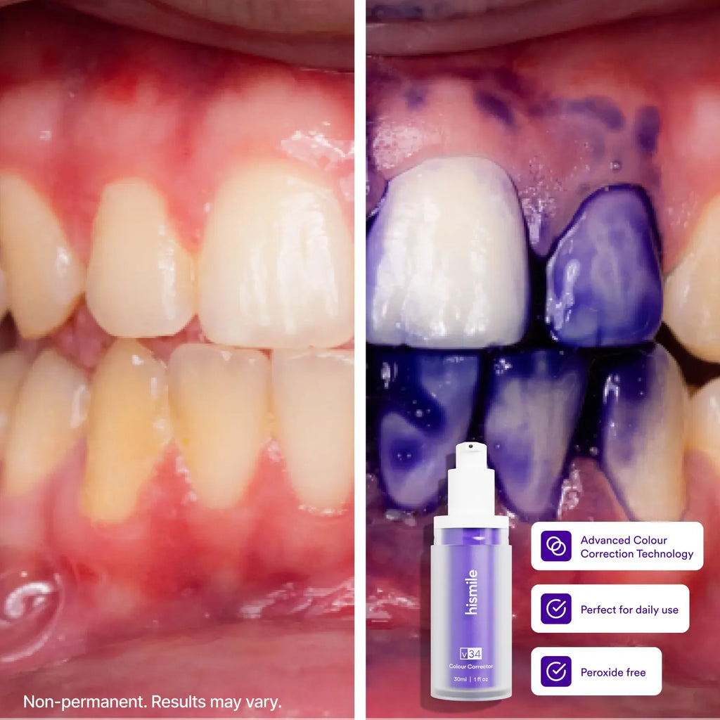 Hismile V34 Colour Corrector - Tooth Stain Concealer, Temporary Brightening Booster, Purple Toothpaste, Colour Correcting, Hismile V34